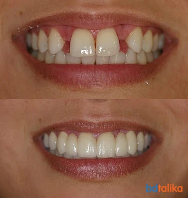 A Cosmetic Dental Clinic:...
